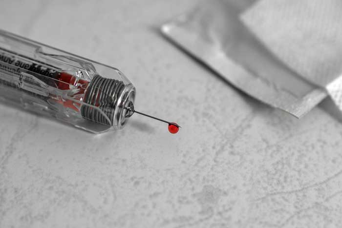 DOH Warns of HIV Risk from ‘Vampire Facial’