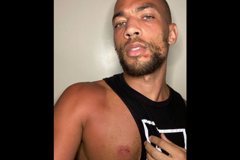 Kendrick Sampson Recounts Police Aggression Following Peaceful Protest in LA