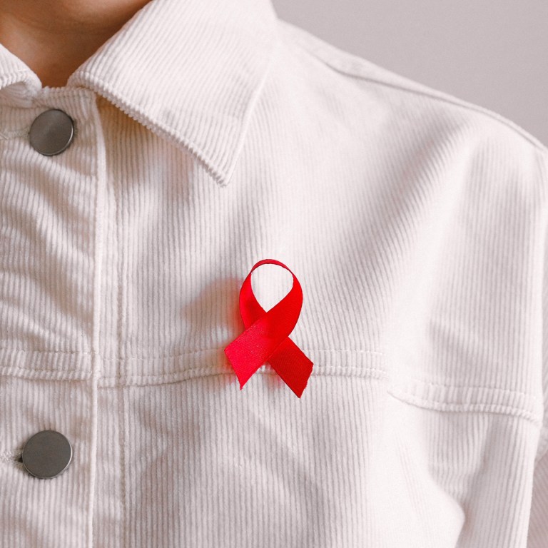 IMG Helps & Artist ESPO Have a Message for World AIDS Day