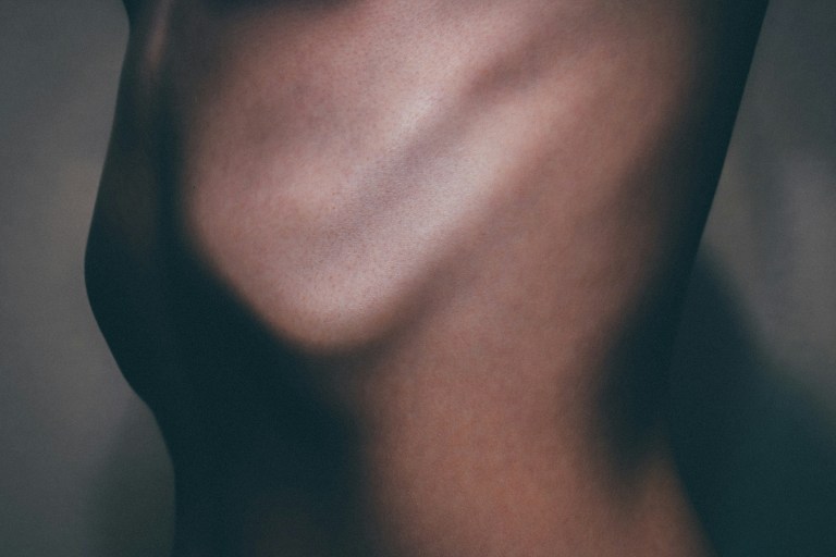 Editor’s Pick: This body care serum helps me thrive with CVID