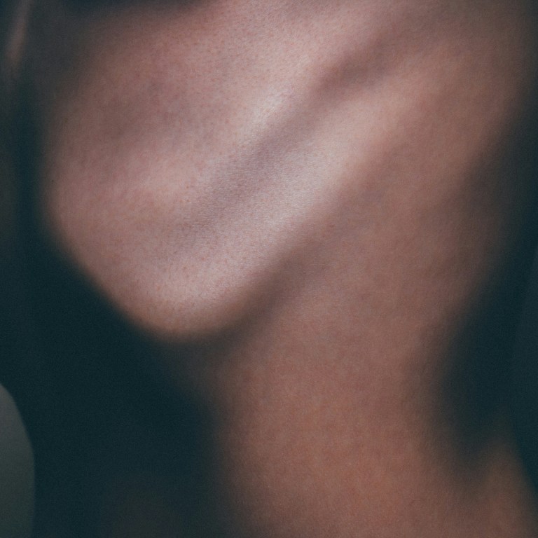 Editor’s Pick: This body care serum helps me thrive with CVID